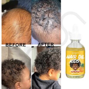 Hair Growth Support Scalp Nourishment Kids Hair Oil For Girls and Boys - Image 7