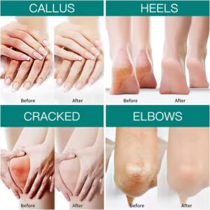 Foot care cream for cracked heels exfoliating anti crack peeling dead skin removal foot repair whitening urea foot cream - Image 5