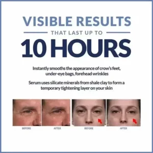 Instant Eye Cream For Anti Aging Dark Circles Bags Puffiness Great Under Eye Skin Tightening Eye Lift Fat Granules Remover Care - Image 6