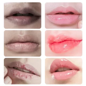 Fast Lightening Pink Mouth Lips Serum Bleaching Permanent Pinkish Moisturizing Lighten Dark Lip Balm Gloss Lipstick Lip Mask - Image 3