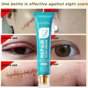 Scar Removal Cream Repair Stretch Marks Burn Acne Surgical Acne Scar Ointment Herbal Treatment Gel Whitening Beauty Health Care - Image 3