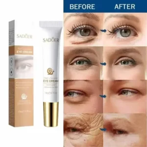 Instant Eye Cream For Anti Aging Dark Circles Bags Puffiness Great Under Eye Skin Tightening Eye Lift Fat Granules Remover Care - Image 4