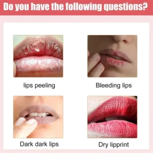 Fast Lightening Pink Mouth Lips Serum Bleaching Permanent Pinkish Moisturizing Lighten Dark Lip Balm Gloss Lipstick Lip Mask - Image 4