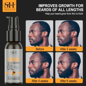 New 2023 Chebe Beard Growth Oil For Men Fast Effective Beard Growth Essential Hair Loss Treatment Product Sevich Beard Care 30ml - Image 3